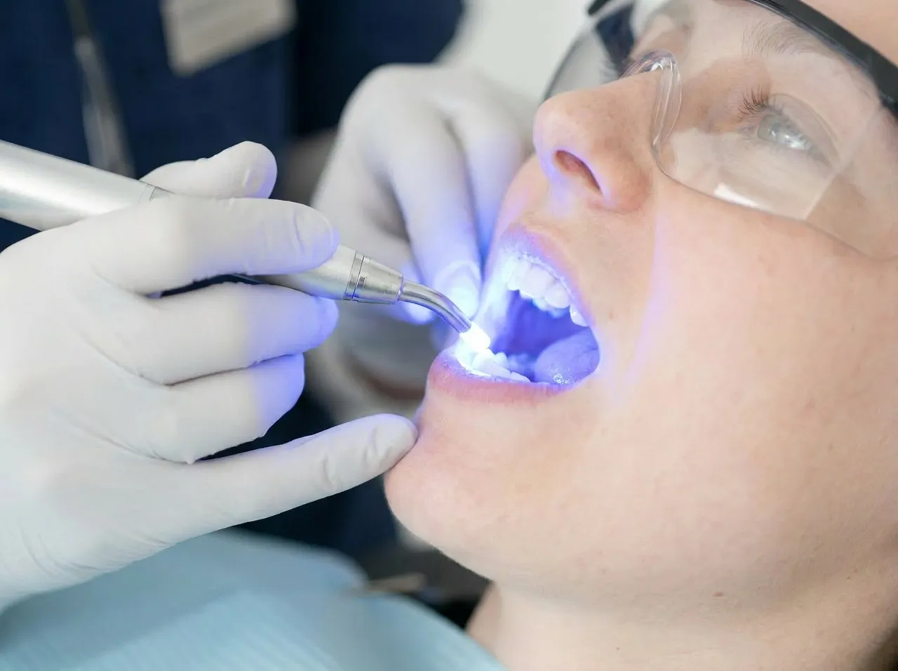 Was bedeutet Laserbehandlung beim Zahnarzt?