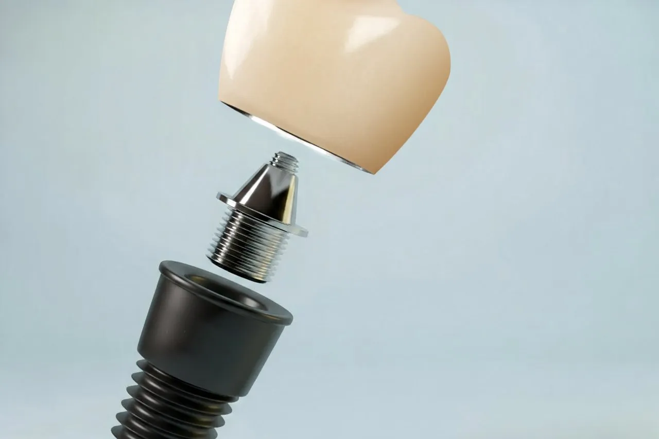 Zahnersatz und Implantate