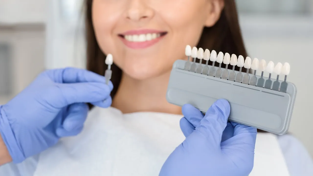 Dental Bonding: Zahnform direkt mit Komposit korrigieren